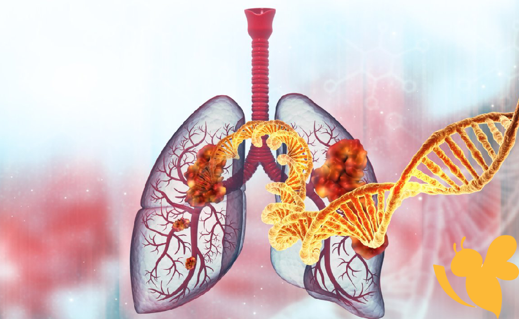 New studies links particulate air pollution to increased mutations in lung cancers among nonsmokers